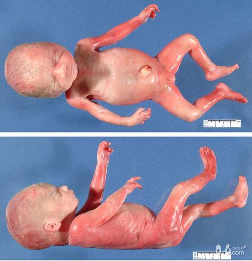 胎儿在子宫内发育的各周形象