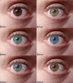 为什么眼睛的颜色会有不同?