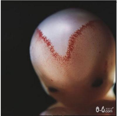 图文详解精子变胎儿的全过程