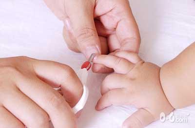 宝宝手指长倒刺如何轻松处理