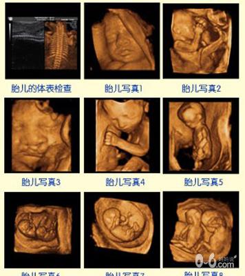 胎儿发育四维彩超图片