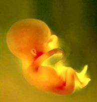 新生儿“超重”好吗？